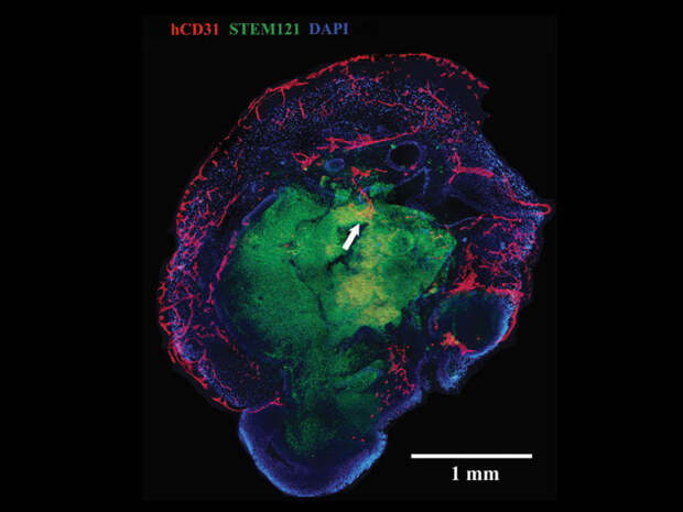 organoid-cross-section-mini-brain-blood-vessels