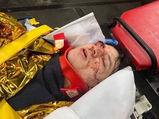 Vacio выпал с третьего этажа в Париже — он в реанимации, состояние критическое