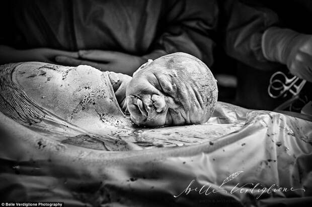 Бэлль Вердильоне сняла роды сразу после кесарева сечения дети, роды, рождение, фотограф