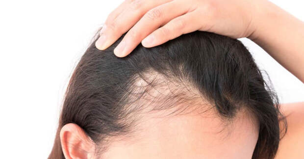 Останови выпадение волос: ТОП-10 продуктов для их укрепления и питания