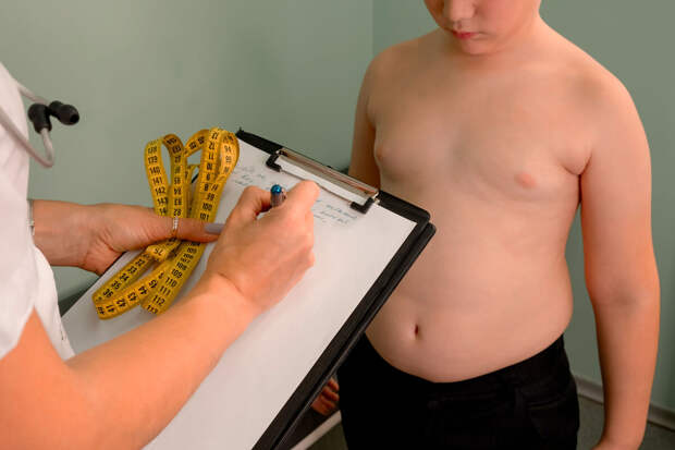 EASO: тяжелое ожирение в четыре года обещает продолжительность жизни в 39 лет