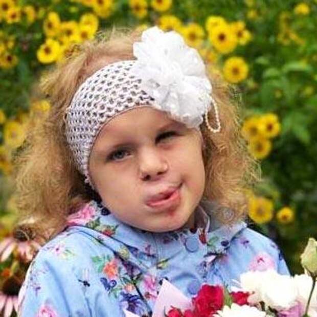 Аня Гаврикова, 9 лет, деформация губы и носа, расщелина альвеолярного отростка, недоразвитие верхней челюсти, требуется ортодонтическое лечение, 84 654 ₽