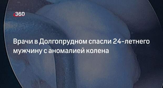 Врачи в Долгопрудном спасли 24-летнего мужчину с аномалией колена