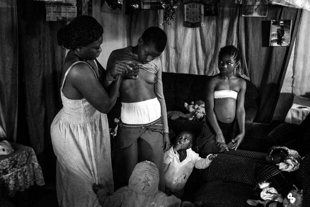 Массаж груди, как метод предотвращения роста груди у девушек, чтобы избежать последующего насилия, Камерун