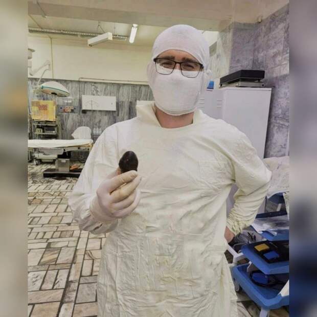 Женщина 86 лет поступила в БУЗОО «ГКБСМП №1» с сильными болями в животе. Ранее пациентка неоднократно испытывала приступы болей после приёма жирной пищи.  Пациентке диагностировали острый холецистит и в неотложным порядке прооперировали. «На операции выявлен был острый гангренозный холецистит и выраженный спаечный процесс в области печени и жёлчного пузыря. А в удаленном желчном пузыре оказался камень 7-8 см, размером примерно с куриное яйцо. Наличие такого большого камня грозило пациентке формированием желчнокаменной непроходимости или холангита. Камень может вызвать пролежень стенки жёлчного пузыря и соседних органов : двенадцатиперстной кишки, тонкой или толстой кишки, желудка, жёлчного протока», — рассказал врач-хирург БСМП № 1 Александр Кинзерский.