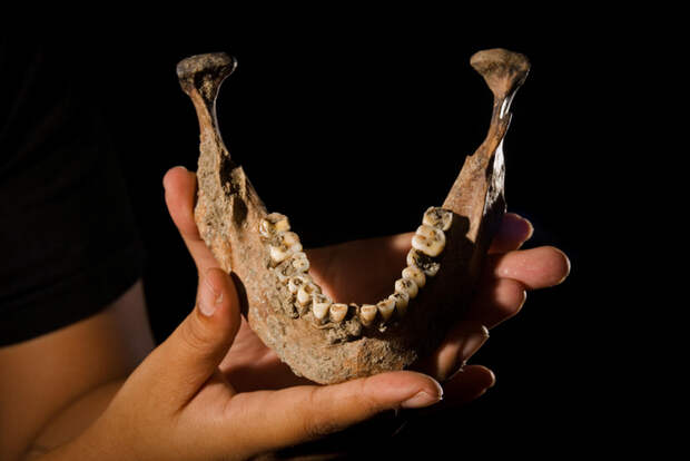 Как лечили зубы древние люди?