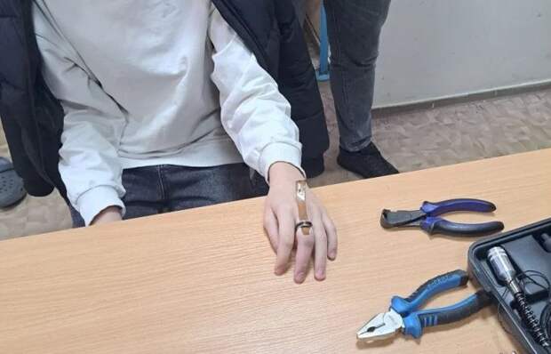 В Астрахани спасатели освободили подростка от кольца, застрявшего на пальце