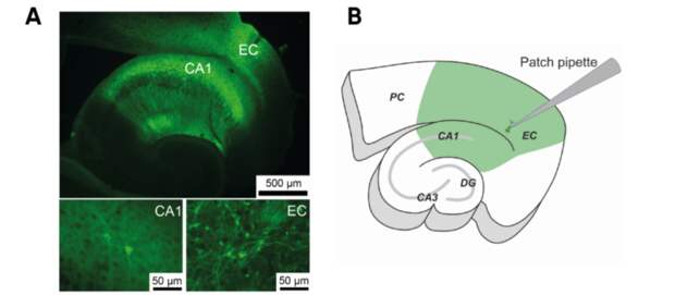 Ученые подавили эпилептическую активность в мозге мыши при помощи зеленого света