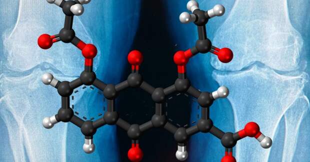 Ингибитор интерлейкина‑1β диацереин не уменьшил боль при остеоартрите колена