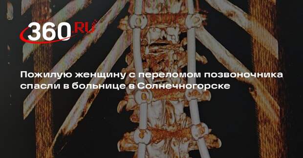 Пожилую женщину с переломом позвоночника спасли в больнице в Солнечногорске