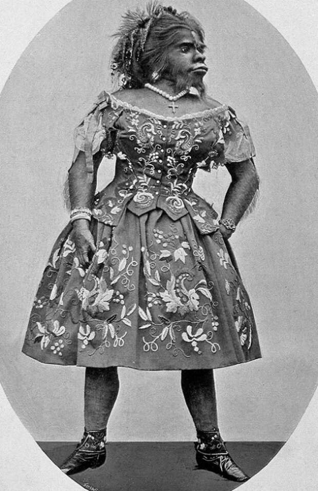 Хулия Пастрана - артистка цирка второй половины XIX века. | Фото: ru.wikipedia.org.