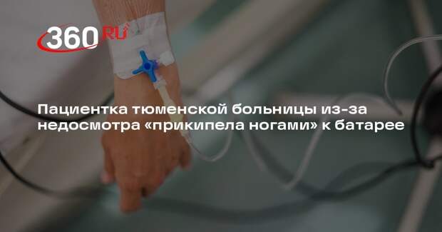 Пациентка тюменской больницы из-за недосмотра «прикипела ногами» к батарее