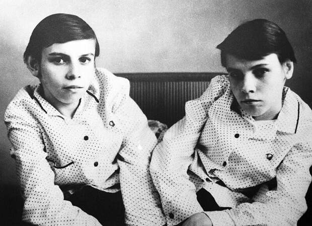 Самые известные сиамские близнецы СССР: жизнь и страдание 