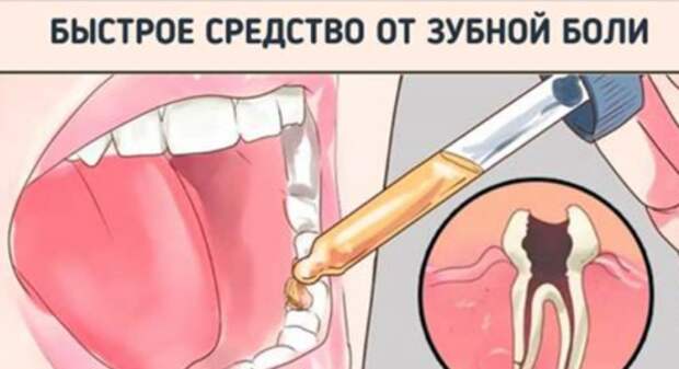 Средство, которое снимет зубную боль за минуту!