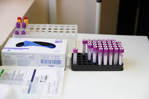 Канда холестерин дәрәҗәсе: ничә яшьтән һәм ничә тапкыр тикшеренергә кирәк?