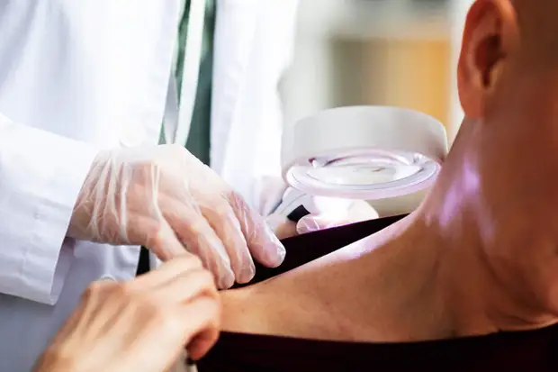 Заразен ли псориаз? И другие факты об этом заболевании, которые нужно знать всем