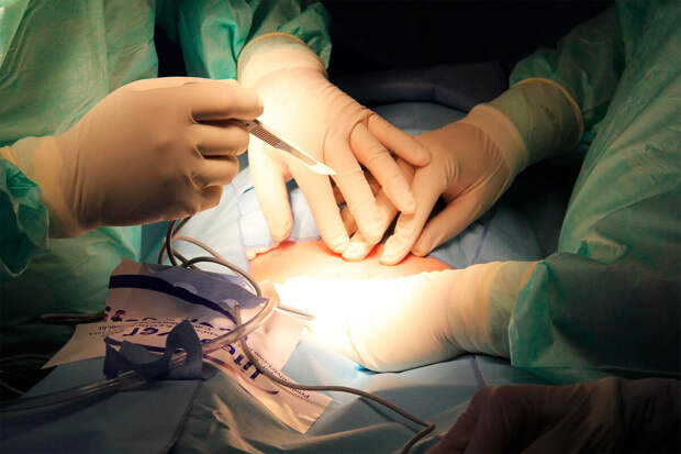 В Липецке врачи спасли женщину с гигантской опухолью яичника