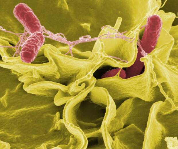 Сальмонеллез - инфекционное заболевание, которое вызывают бактерии рода Salmonella