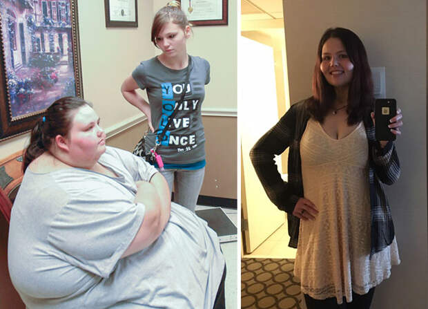 Christina Philips Was 708 Lbs, She Dropped To 183 Lbs