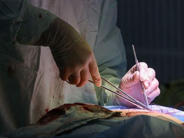 До 90 процентов сложных вмешательств тюменцам проводится в своём регионе