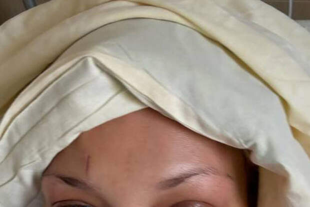 Модель Белла Хадид почувствовала себя ненужной из-за болезни Лайма