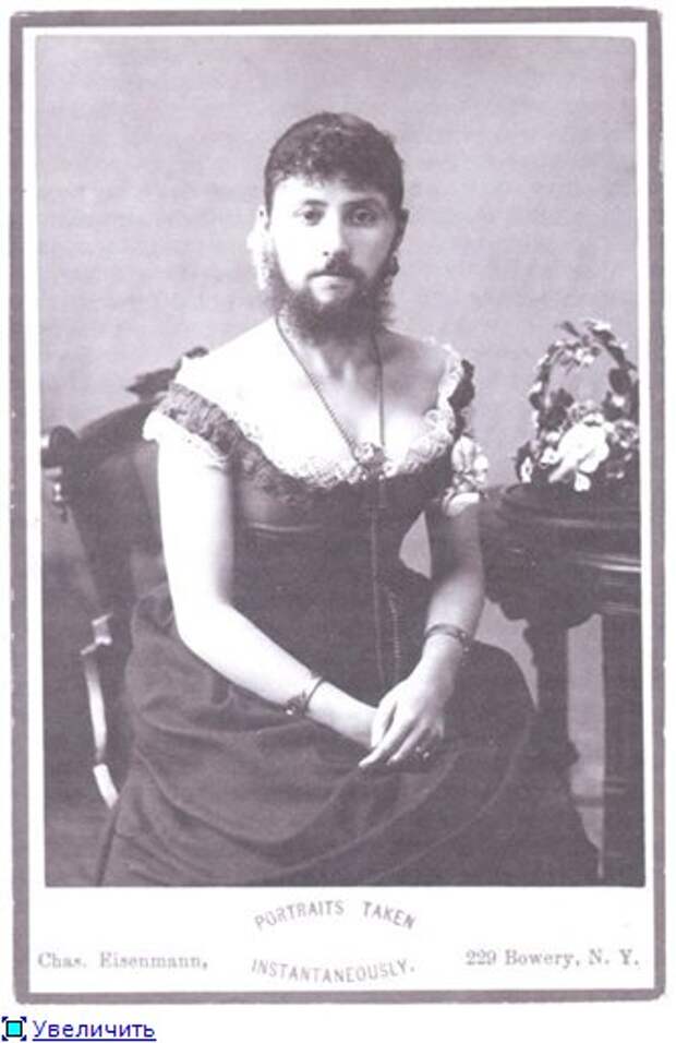 Вирильный синдром. Портрет бородатой женщины. Женщина с бородой. Женщина с бородой 19 век.