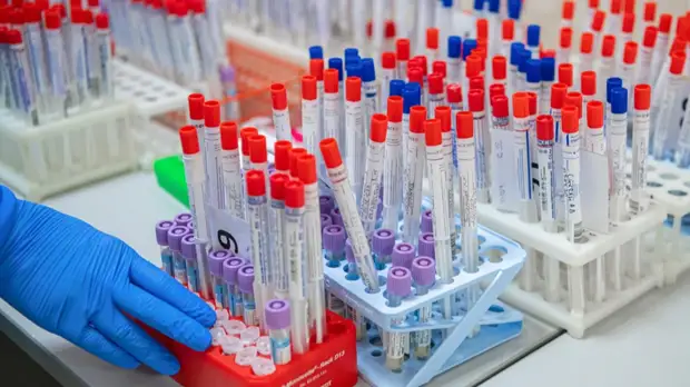 В Москве за сутки выявили 5847 случаев заболевания коронавирусом