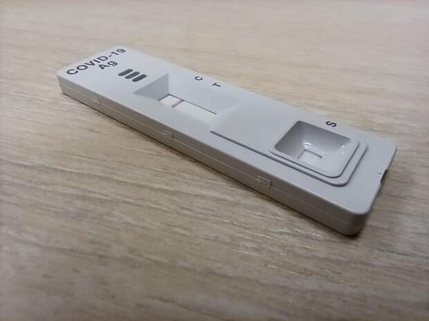 Роспотребнадзор заявил об отсутствии в РФ выявленных случаев COVID-19 «Цикада»