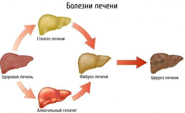 10 возможных причин боли в области печени