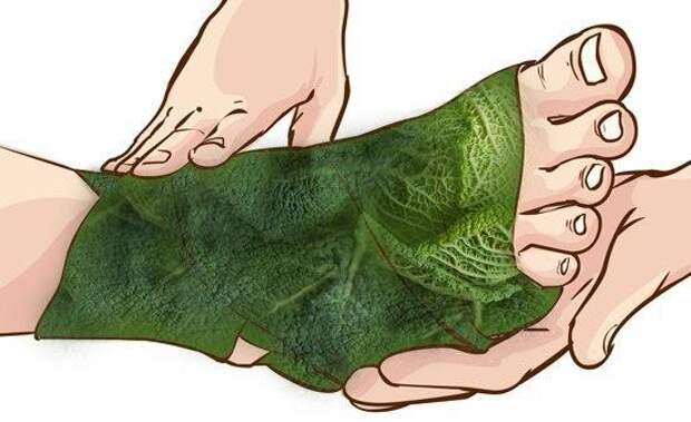 Лечение суставов капустным листом