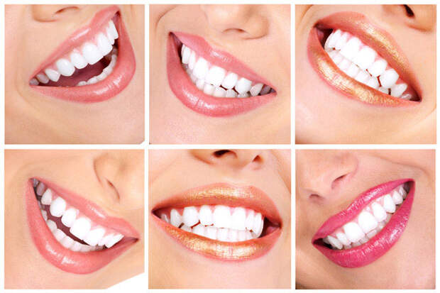 Безопасные способы отбеливания зубов дома