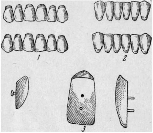 Зубы и крампоны. Крампоны это "гвоздики", которые торчат из плоской поверхности фарфорового "зуба". Те, что с шапочками - пугоовчатые крампоны, а те, что представляют собой цилиндрики - цилиндрические крампоны. Они несколько различаются способами крепления.