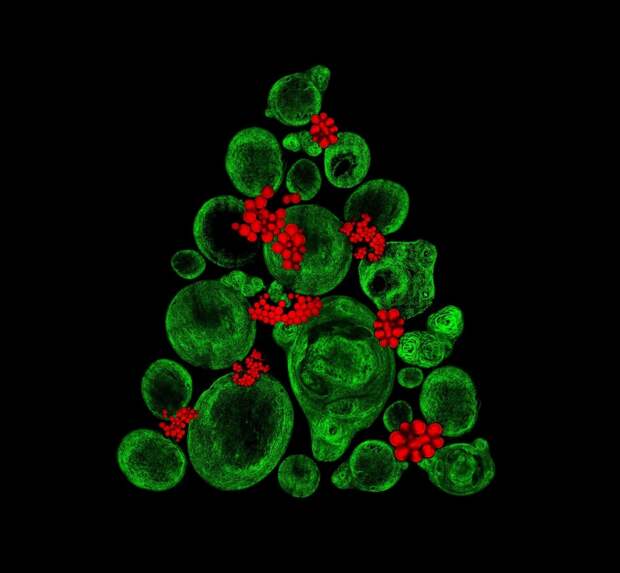 Девятое место — Выращивание хрящевой ткани в лаборатории с использованием костных стволовых клеток (зеленые «шарики» — коллагеновые волокна, красные — жировые отложения) Nikon Small World’s, конкурс, красота, наука, под микроскопом, удивительно