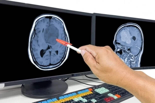 Психолог Юрченко раскрыла главный секрет здоровья мозга