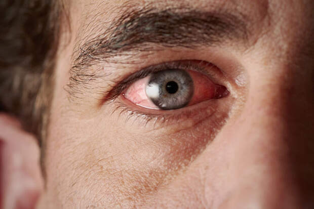 NatMicro: вирус креветок привел к нескольким случаям слепоты в Китае