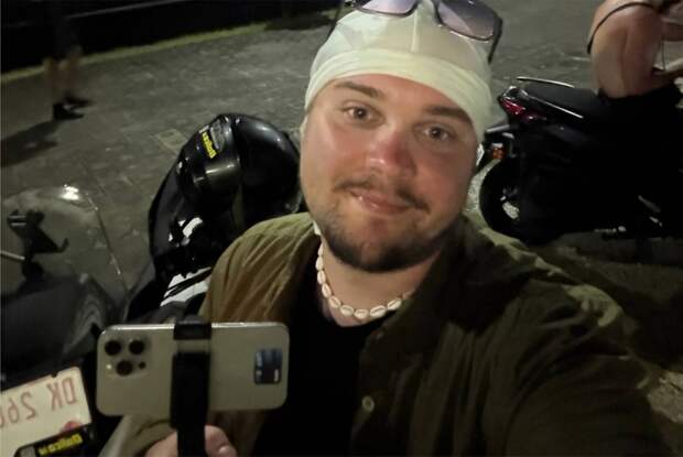 Популярный российский блогер травмировался на Бали