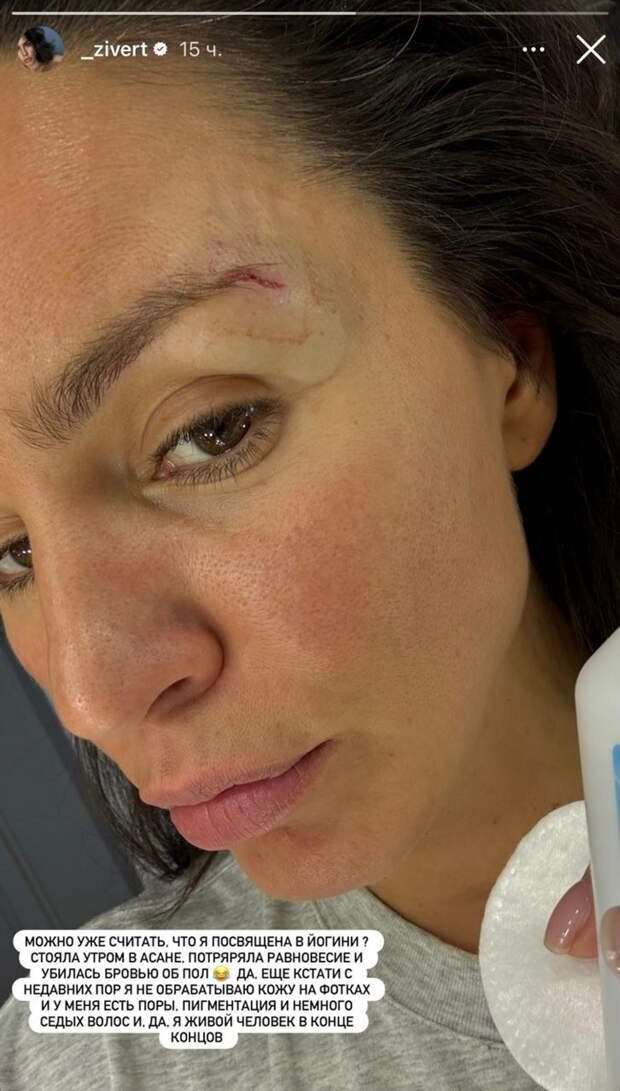 Zivert получила травму во время тренировки по йоге