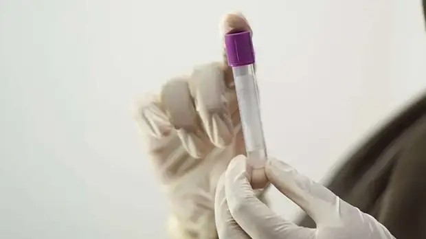 Sasapost: США поставили мир на грань новой пандемии и чумы