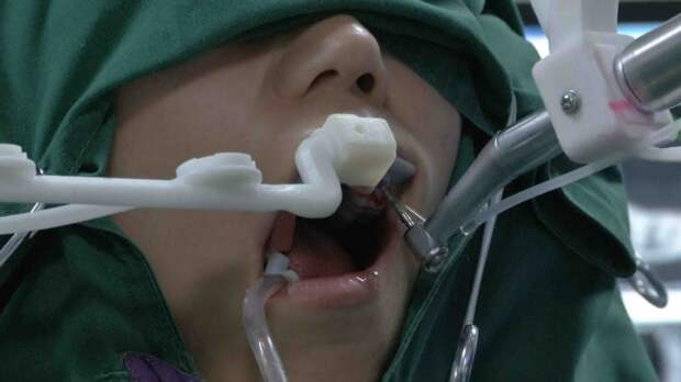В Китае робот-стоматолог впервые вставил зубы человеку
