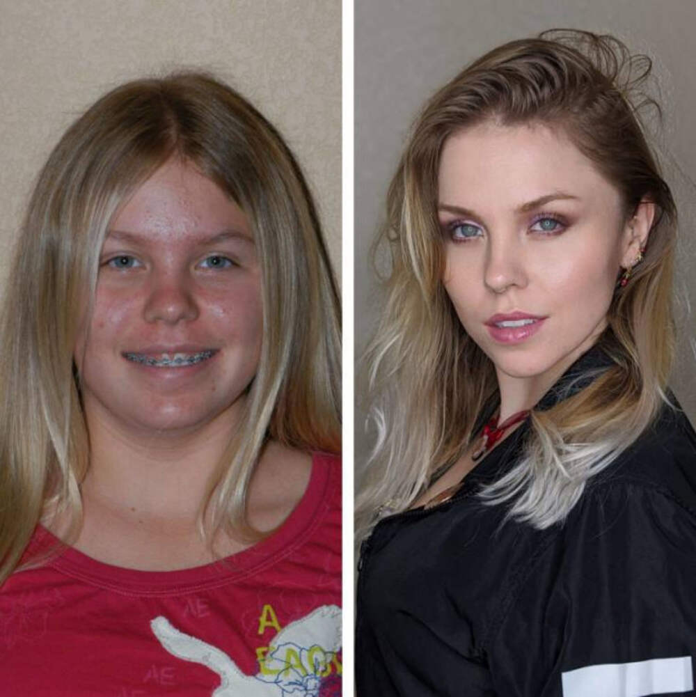 Как люди менялись внешне. Изменения девушек до и после. Изменение внешности до и после. Изменение внешности с возрастом девушки. Подростковый Возраст внешность.