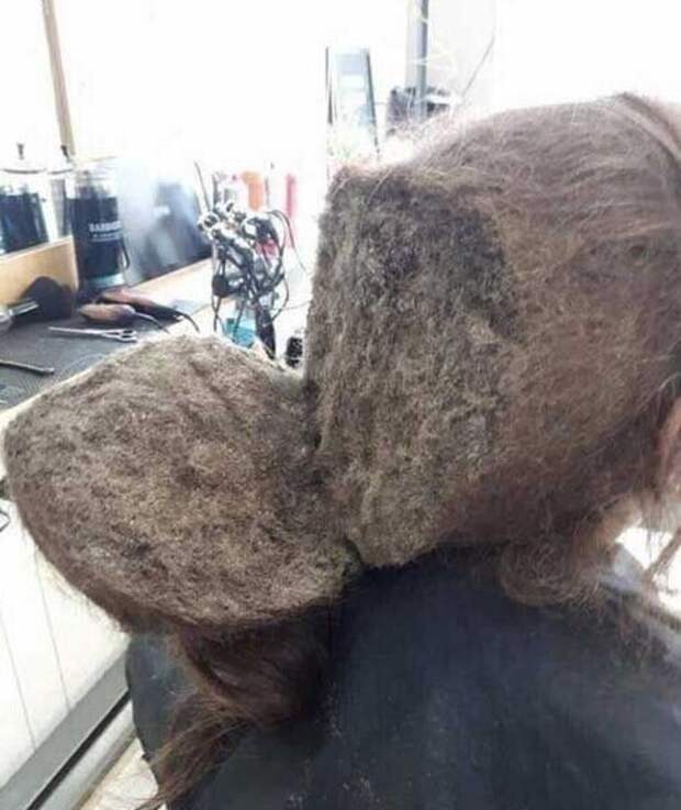 Это не генетика, это гигиена Это не генетика, это гигиена