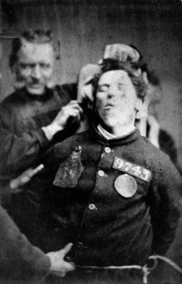 11. Пациент психиатрической лечебницы в Йоркшире, Англия, 1869 год век, мир, прошлое, снимок, событие, странность, фотография