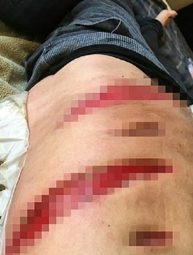 Укус паука и вы больше не веган, или здоровье превыше принципов Укус паука и вы больше не веган, или здоровье превыше принципов