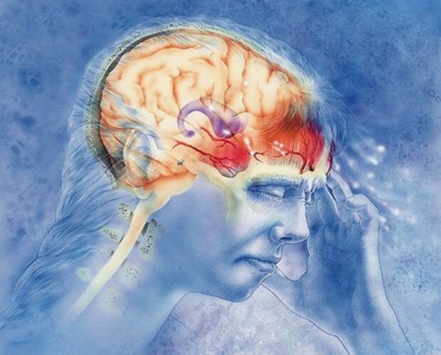 Как вылечить головную боль — новое открытие в области медицины