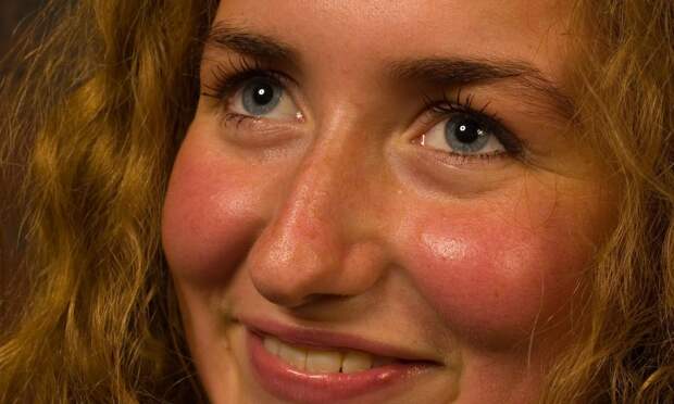 Сахарное лицо: как избыток сладостей и выпечки склеивает коллаген и «поджаривает» белки