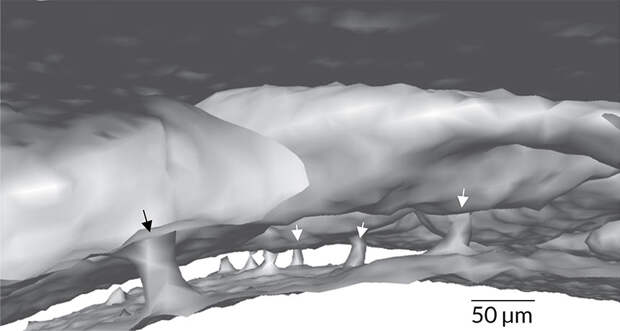 skull channels