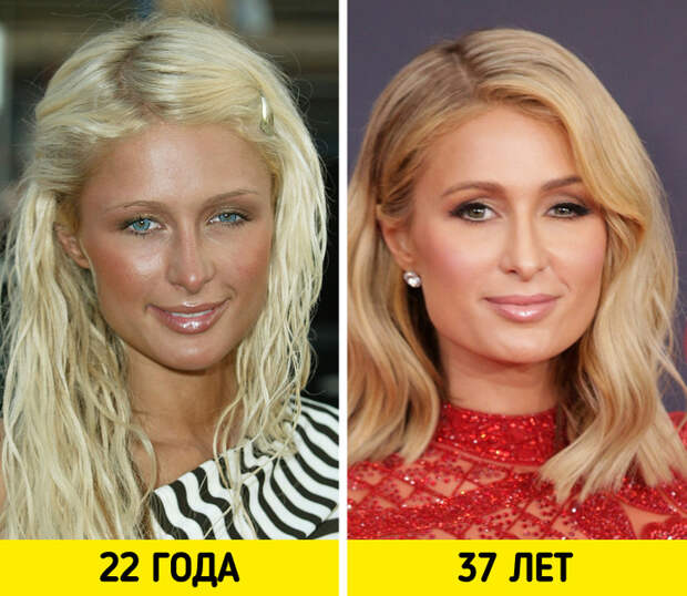 Снимки знаменитостей, которые с возрастом стали только краше