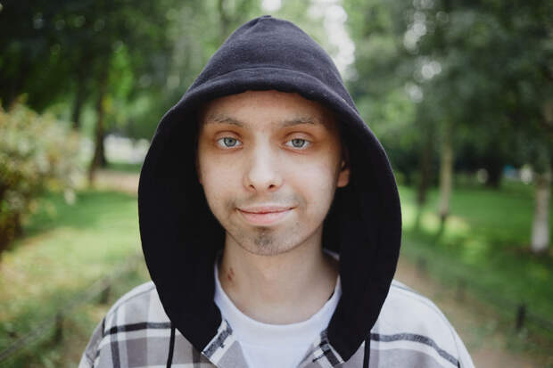 «Терапию нужно начать уже сейчас». 16-летнему спортсмену нужна поддержка в борьбе с редким заболеванием