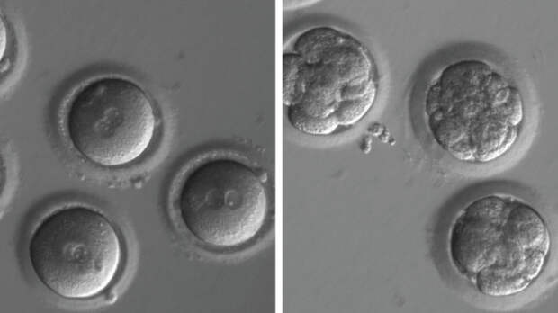 Embryonic Human DNA Has Just Been Successfully Repaired in the U.S.