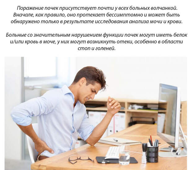 15 неприметных симптомов волчанки, которые нельзя игнорировать